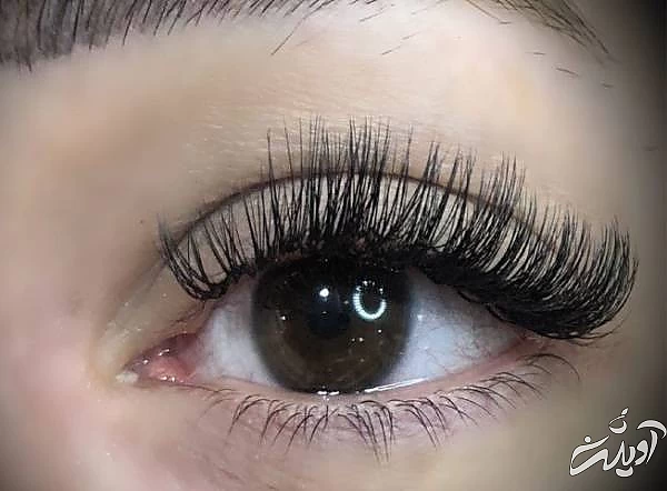 کاشت مژه مصنوعی چه عوارضی دارد؟ کاشت مژه مصنوعی
